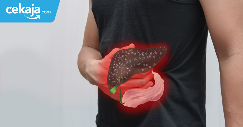 Cara Ini Ampuh Mencegah Sakit Liver