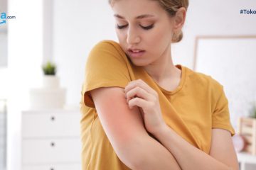 Jenis-jenis Alergi pada Kulit Beserta Gejala dan Cara Mengobatinya