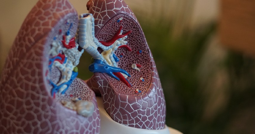 Penyakit Paru-paru - 6 Penyakit dengan Biaya Pengobatan Termahal