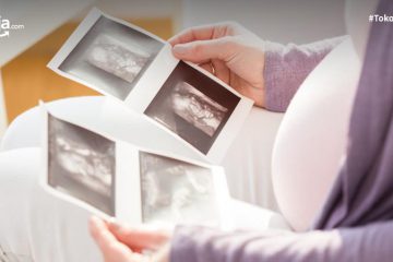 Cara Membaca Hasil USG Kehamilan yang Tepat, Ibu Gak Usah Bingung!