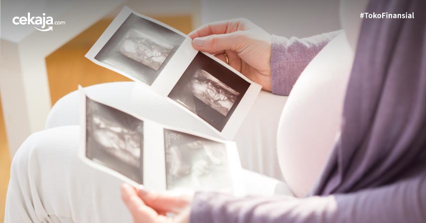 Cara Membaca Hasil USG Kehamilan yang Tepat, Ibu Gak Usah Bingung!