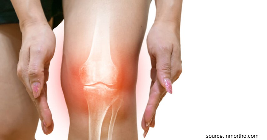 Jenis-jenis Peradangan Sendi - Osteoarthritis