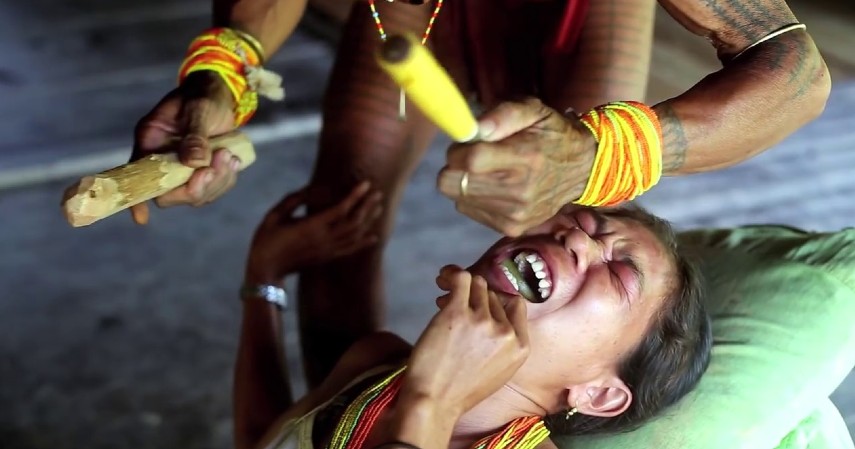 Tradisi Paling Ekstrim di Indonesia - Tradisi Kerik Gigi Wanita Mentawai