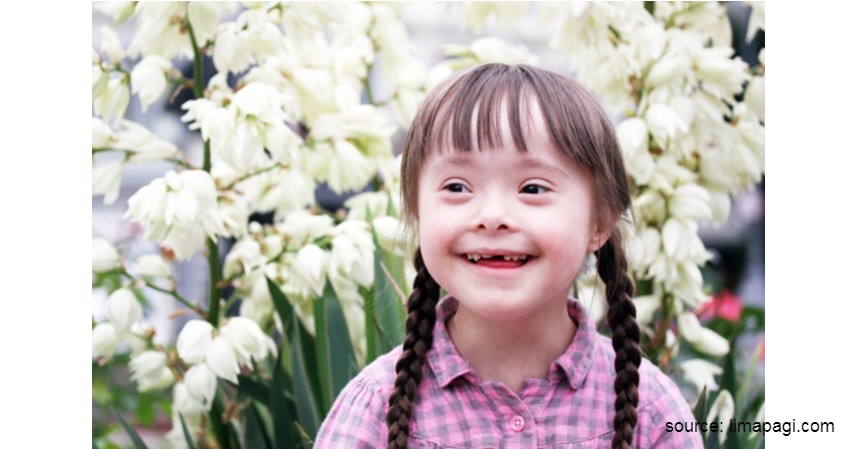 Down Syndrome - Perbedaan Autis dan Down Syndrome