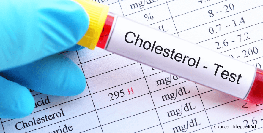 Penurun Kadar Kolesterol - Manfaat Bawang Putih Tunggal bagi Kesehatan