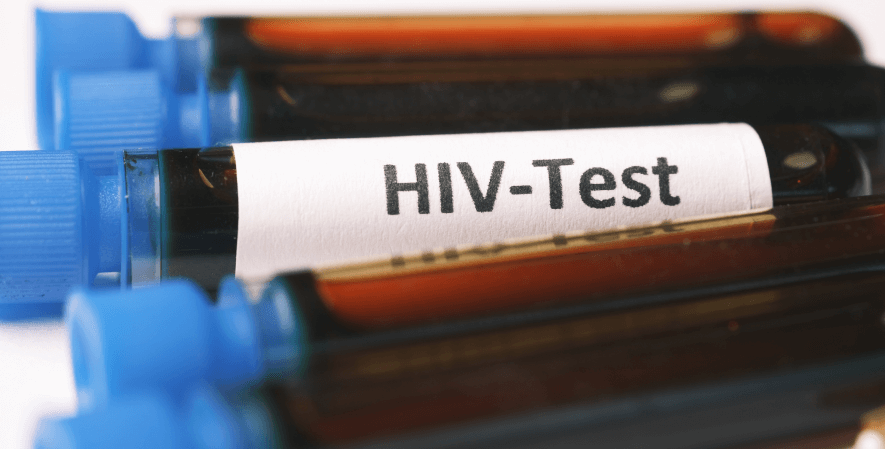 HIV Merupakan Virusnya - Pahami Perbedaan HIV dan AIDS