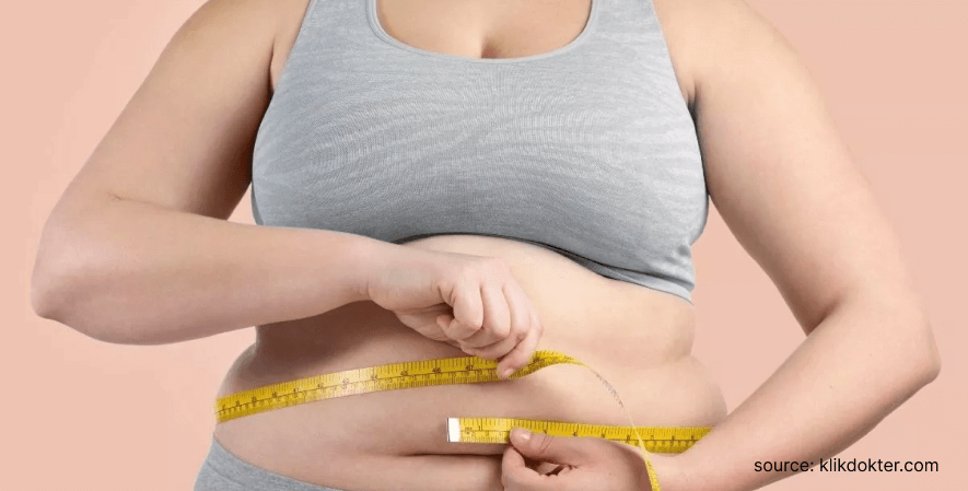 5. Obesitas - 9 Masalah Kesehatan Milenial